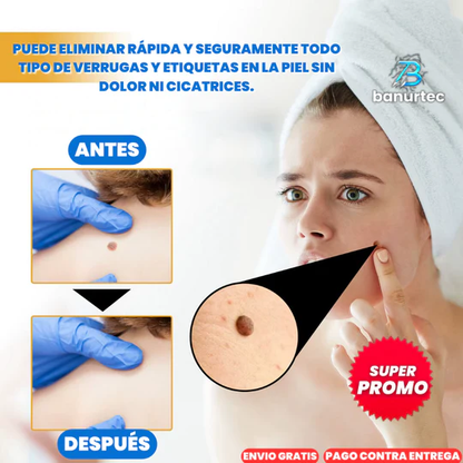 TAG RECEDE-ELIMINADOR DE VERRUGAS, LUNARES Y MANCHAS