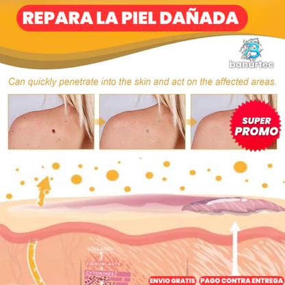 TAG RECEDE-ELIMINADOR DE VERRUGAS, LUNARES Y MANCHAS